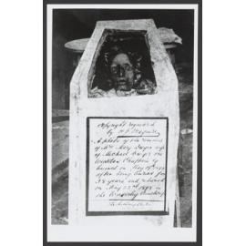 Irish Monument. Exhumed remains of Mary Dwyer at Devonshire Street Cemetery in preparation to being re interred in Irish monument, Waverley Cemetery.